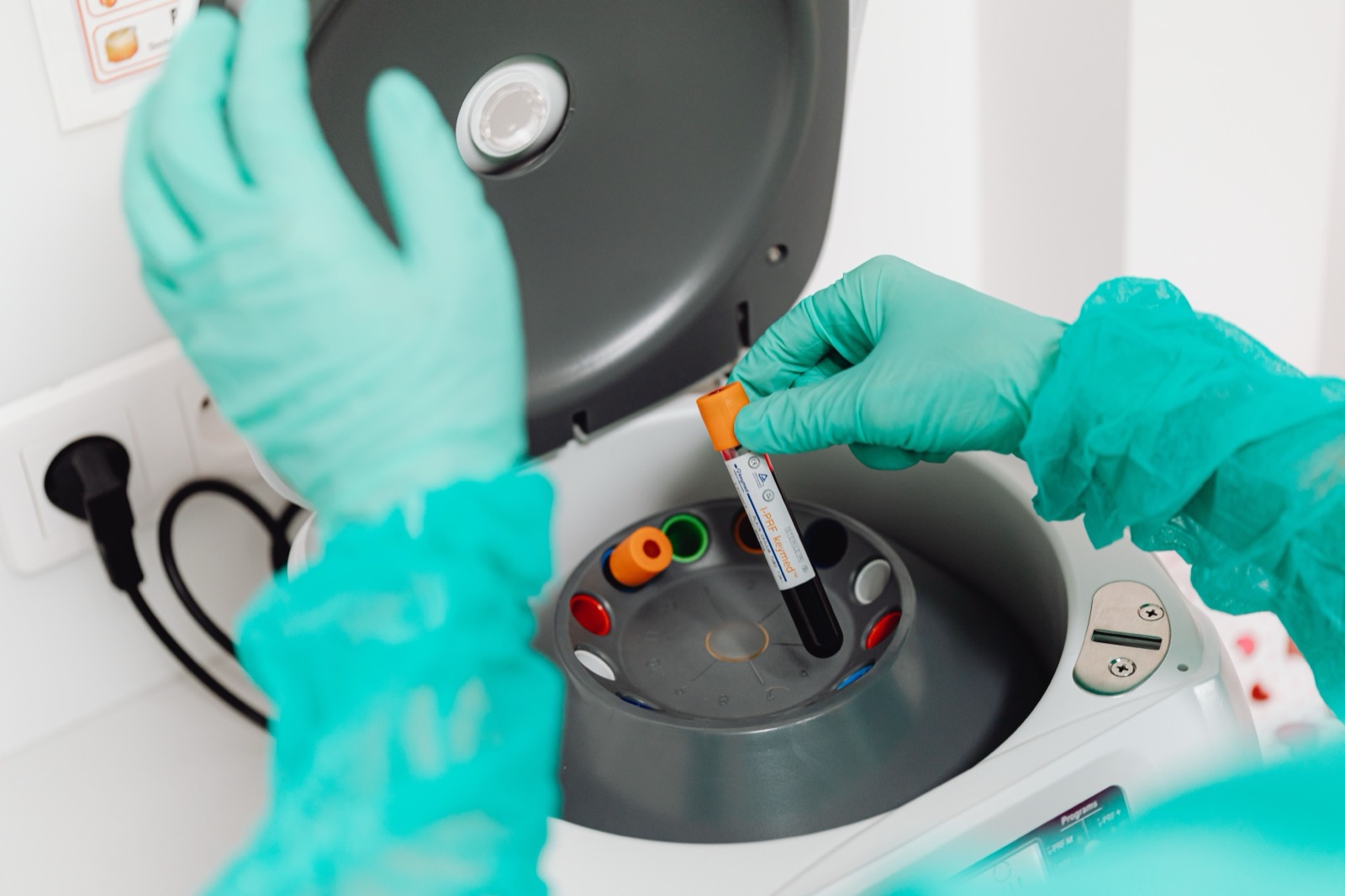 Labortechnikerin bei der Blutprobenanalyse – CTU-Kriterien Abstinenzkontrolle